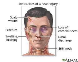 Head Injury